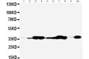 Anti-Annexin V antibody, Western blotting All lanes: Anti Annexin V  at 0. (Annexin V anticorps  (Middle Region))