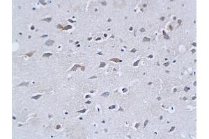 Formalin-fixed and paraffin embedded mouse brain tissue labeled with Rabbit Anti-NF-H/Neurofilament H/Neurofilament 200 Polyclonal Antibody (ABIN672156), Unconjugated followed by conjugation to the secondary antibody and DAB staining (NEFH anticorps  (AA 1-100))