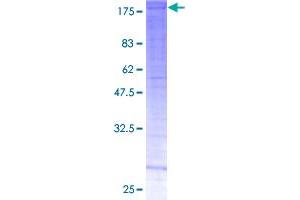 Image no. 1 for SWI/SNF Related, Matrix Associated, Actin Dependent Regulator of Chromatin, Subfamily C, Member 2 (SMARCC2) (AA 1-1130) protein (GST tag) (ABIN1320637)