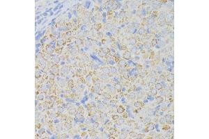 Immunohistochemistry of paraffin-embedded rat ovary using ACADL antibody (ABIN1678519, ABIN3015429, ABIN3015430 and ABIN6216381) at dilution of 1:100 (40x lens).