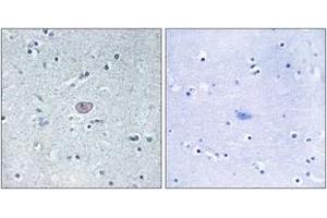 Immunohistochemistry (IHC) image for anti-VEGF Receptor 2 (VEGFR2) (AA 917-966) antibody (ABIN2889081) (VEGFR2/CD309 anticorps  (AA 917-966))