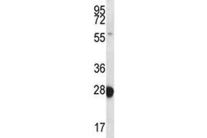 RAB27B antibody western blot analysis in MDA-MB435 lysate. (RAB27B anticorps  (AA 121-150))