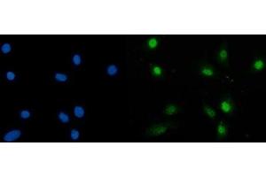 anti-Strawberry Notch Homolog 1 (SBNO1) (AA 43-1303) antibody