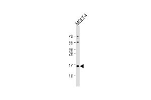 Anti-CRABP1 Antibody (C-term) at 1:1000 dilution + MOLT-4 whole cell lysate Lysates/proteins at 20 μg per lane. (CRABP1 anticorps  (C-Term))
