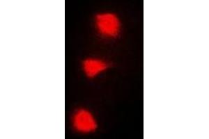 Immunofluorescent analysis of SPZ1 staining in A549 cells. (SPZ1 anticorps  (N-Term))