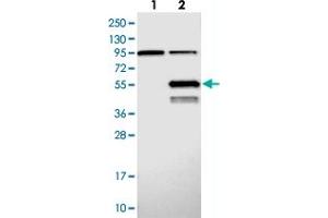 Western blot analysis of Lane 1: Negative control (vector only transfected HEK293T lysate), Lane 2: Over-expression Lysate (Co-expressed with a C-terminal myc-DDK tag (~3. (ABHD2 anticorps)