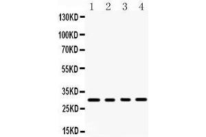 Western Blotting (WB) image for anti-Tumor Necrosis Factor (Ligand) Superfamily, Member 13b (TNFSF13B) (AA 134-285) antibody (ABIN3043751) (BAFF anticorps  (AA 134-285))