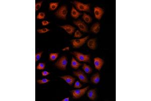 Immunofluorescence analysis of NIH/3T3 cells using DBI Rabbit pAb (ABIN6127407, ABIN6139420, ABIN6139422 and ABIN6217234) at dilution of 1:100 (40x lens).
