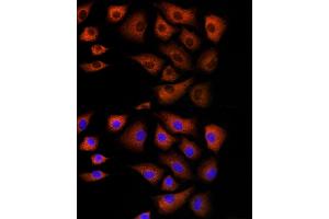 Immunofluorescence analysis of NIH/3T3 cells using DBI Rabbit pAb (ABIN6127407, ABIN6139420, ABIN6139422 and ABIN6217234) at dilution of 1:100 (40x lens). (Diazepam Binding Inhibitor anticorps  (AA 1-114))