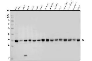 Western blot analysis of MCU using anti-MCU antibody (ABIN7601931). (MCU anticorps  (AA 51-351))