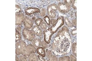 Immunohistochemical staining of human kidney with ZC3H12A polyclonal antibody  shows strong cytoplasmic positivity in cells in tubules at 1:200-1:500 dilution. (ZC3H12A anticorps)