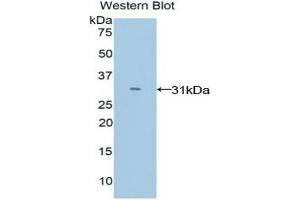 Detection of Recombinant MYO1E, Mouse using Polyclonal Antibody to Myosin IE (MYO1E)