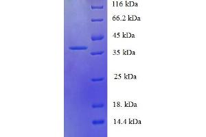 SDS-PAGE (SDS) image for Chemokine (C-C Motif) Ligand 19 (CCL19) (AA 22-98) protein (GST tag) (ABIN5711737)