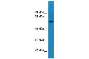 WB Suggested Anti-CNDP1 Antibody Titration: 0. (CNDP1 anticorps  (C-Term))