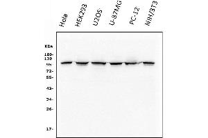 Western blot analysis of CTNNA1 using anti-CTNNA1 antibody (ABIN7600057).