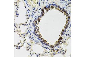 Immunohistochemistry of paraffin-embedded rat lung using ACO1 antibody (ABIN1877037) (40x lens).