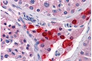 Human Testis: Formalin-Fixed, Paraffin-Embedded (FFPE)