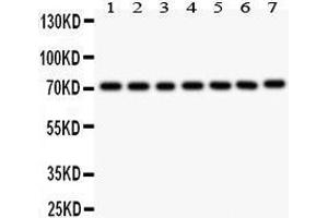 Anti- FOXO3A antibody, Western blotting All lanes: Anti FOXO3A  at 0.