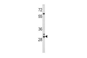Western blot analysis of HLA-DRB1 Antibody (N-term) (ABIN390872 and ABIN2841088) in WiDr cell line lysates (35 μg/lane).