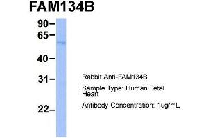 Host:  Rabbit  Target Name:  FAM134B  Sample Type:  Human Fetal Heart  Antibody Dilution:  1.