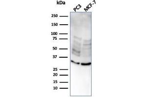 Western Blot Analysis of PC3 and MCF-7 cell lysate usingNKX2.