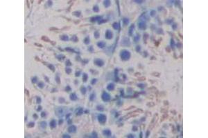 IHC-P analysis of Human Tissue, with DAB staining. (UGT8 anticorps  (AA 198-541))