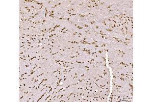 IHC analysis of SPHK1 using anti-SPHK1 antibody (ABIN7600168).