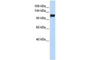 WB Suggested Anti-FAM120A Antibody Titration: 0. (FAM120A anticorps  (Middle Region))