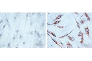 IHC of human skin fibroblasts (Left: control, Right: 24 hours after 7th passage of senescence). (HSPD1 anticorps)