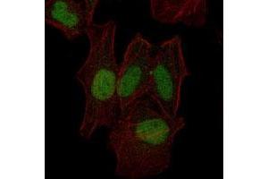 Immunofluorescence analysis of HeLa cells using MAP2K7 monoclonal antibody, clone 4E5  (green). (MAP2K7 anticorps)