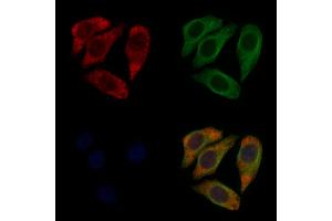 ABIN6258888 and ABIN6274835 staining Hela cells by IF/ICC. (SGCA anticorps  (Internal Region))