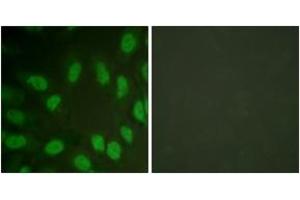 Immunofluorescence analysis of HeLa cells, using AML1 (Ab-303) Antibody. (RUNX1 anticorps  (AA 269-318))
