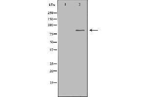 Western blot analysis of extracts of colo , using CHAT antibody. (Choline Acetyltransferase anticorps  (C-Term))