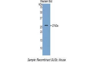 Western blot analysis of the recombinant protein. (Glucuronidase beta anticorps  (AA 451-648))