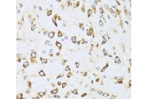 Immunohistochemistry of paraffin-embedded Mouse brain using NRG4 Polyclonal Antibody at dilution of 1:100 (40x lens).