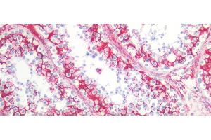 Detection of VIM in Human Testis Tissue using Monoclonal Antibody to Vimentin (VIM)