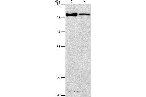 Western blot analysis of Lovo cell and human fetal brain tissue, using ADCY3 Polyclonal Antibody at dilution of 1:312. (ADCY3 anticorps)