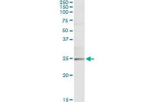 Immunoprecipitation of TWIST1 transfected lysate using anti-TWIST1 monoclonal antibody and Protein A Magnetic Bead , and immunoblotted with TWIST1 MaxPab rabbit polyclonal antibody.