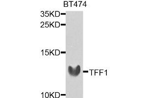 Western blot analysis of extracts of BT-474 cells, using TFF1 antibody. (TFF1 anticorps)