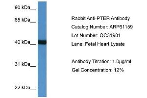 Western Blotting (WB) image for anti-Phosphotriesterase Related (PTER) (N-Term) antibody (ABIN2788700) (PTER anticorps  (N-Term))