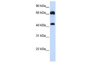 GUCY1B3 antibody used at 1 ug/ml to detect target protein. (GUCY1B3 anticorps  (N-Term))