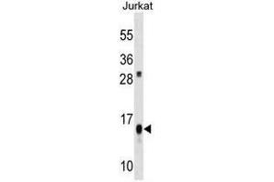 ATP5D Antibody (C-term) western blot analysis in Jurkat cell line lysates (35µg/lane). (ATP5F1D anticorps  (C-Term))