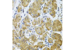 Immunohistochemistry of paraffin-embedded human stomach using PLCG1 Antibody (ABIN2737388) at dilution of 1:100 (40x lens).