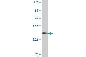 Western Blot detection against Immunogen (37. (HOXB1 anticorps  (AA 101-210))
