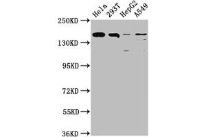 Western Blot Positive WB detected in: Hela whole cell lysate, 293T whole cell lysate, HepG2 whole cell lysate, A549 whole cell lysate All lanes: BRD4 antibody at 1:1500 Secondary Goat polyclonal to rabbit IgG at 1/50000 dilution Predicted band size: 153, 81, 89 kDa Observed band size: 153 kDa (Recombinant BRD4 anticorps)