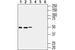 Western blot analysis of human Burkitt's lymphoma Daudi (lanes 1 and 3), human T-cell leukemia Jurkat (lanes 2 and 5) and human breast adenocarcinoma MCF-7 cell lysates (lanes 3 and 6): - 1-3. (Septin 7 anticorps  (Intracellular))