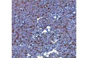 IHC analysis of CCXCR1/XCR1 using anti-CCXCR1/XCR1 antibody (ABIN7600872).
