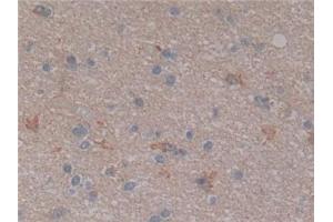 Detection of NFkB in Human Cerebrum Tissue using Polyclonal Antibody to Nuclear Factor Kappa B (NFkB)