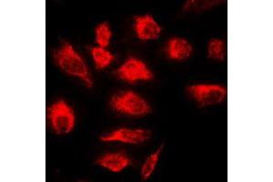 Immunofluorescent analysis of A20 staining in HeLa cells. (IGKV1-27 anticorps  (Center))