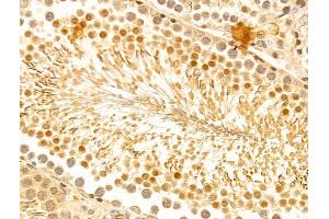 ABIN7094244 and ABIN7098291 at 1/100 staining Rat testis tissue by IHC-P. (FZR1 anticorps  (Internal Region))